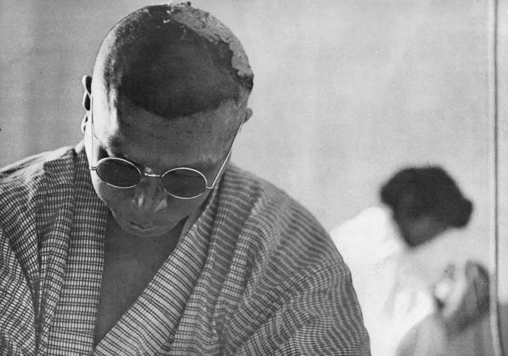 「水爆はごめんだ （1954年のビキニ水爆実験で死の灰を浴びた第五福竜丸の乗組員の増田三次郎氏）」 吉村正治&nbsp;-&nbsp;カメラ毎日 1954年6月号より